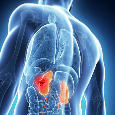 Заболевания почек